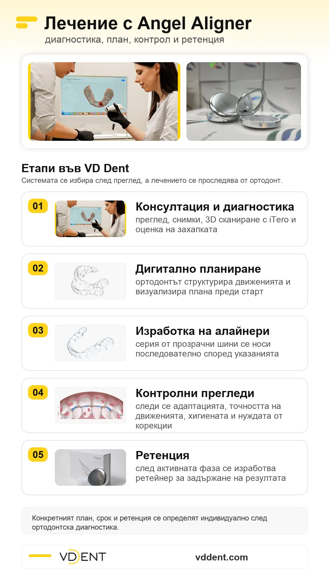 angel-aligner-lechenie-proces-diagnostika-planirane-kontrol-retentsiya-vd-dent-sofia-final-03 Инфографика за етапите на лечение с Angel Aligner във VD Dent София - диагностика, дигитално планиране, изработка на алайнери, контролни прегледи и ретенция